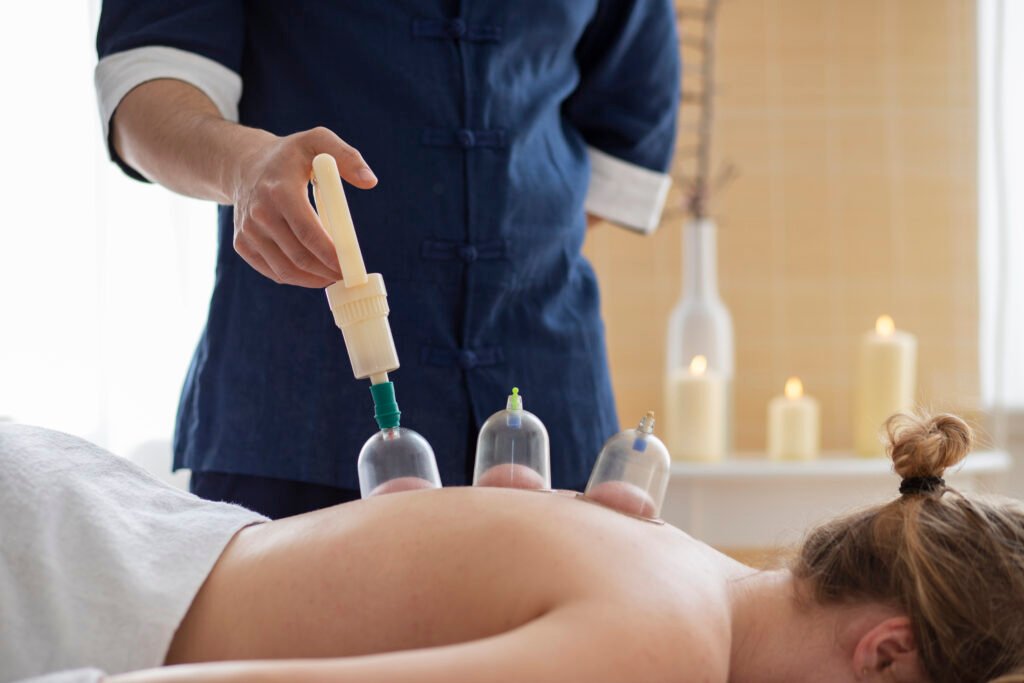 Cupping therapy session showing cups applied to the back to promote healing and cupping therapy benefits.