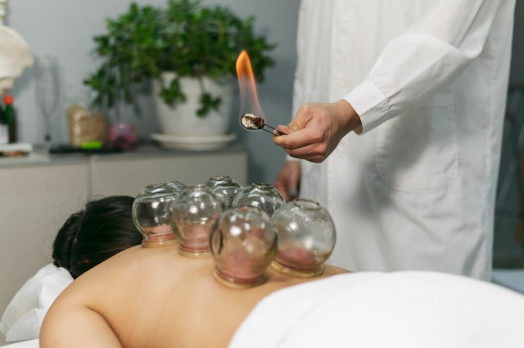 Cupping therapy session showing cups applied to the back to promote healing and cupping therapy benefits.